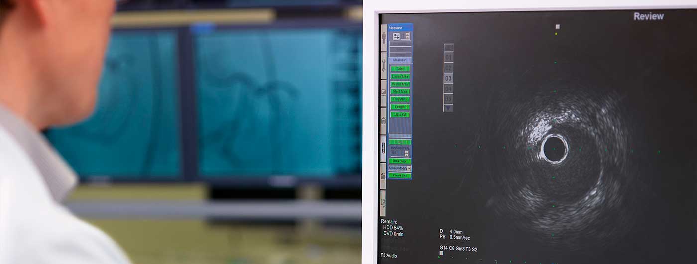 IVUS 心臓カテーテル　心カテ IVUS画像の見方を覚えるエクササイズだ！｜心カテブートキャンプ
